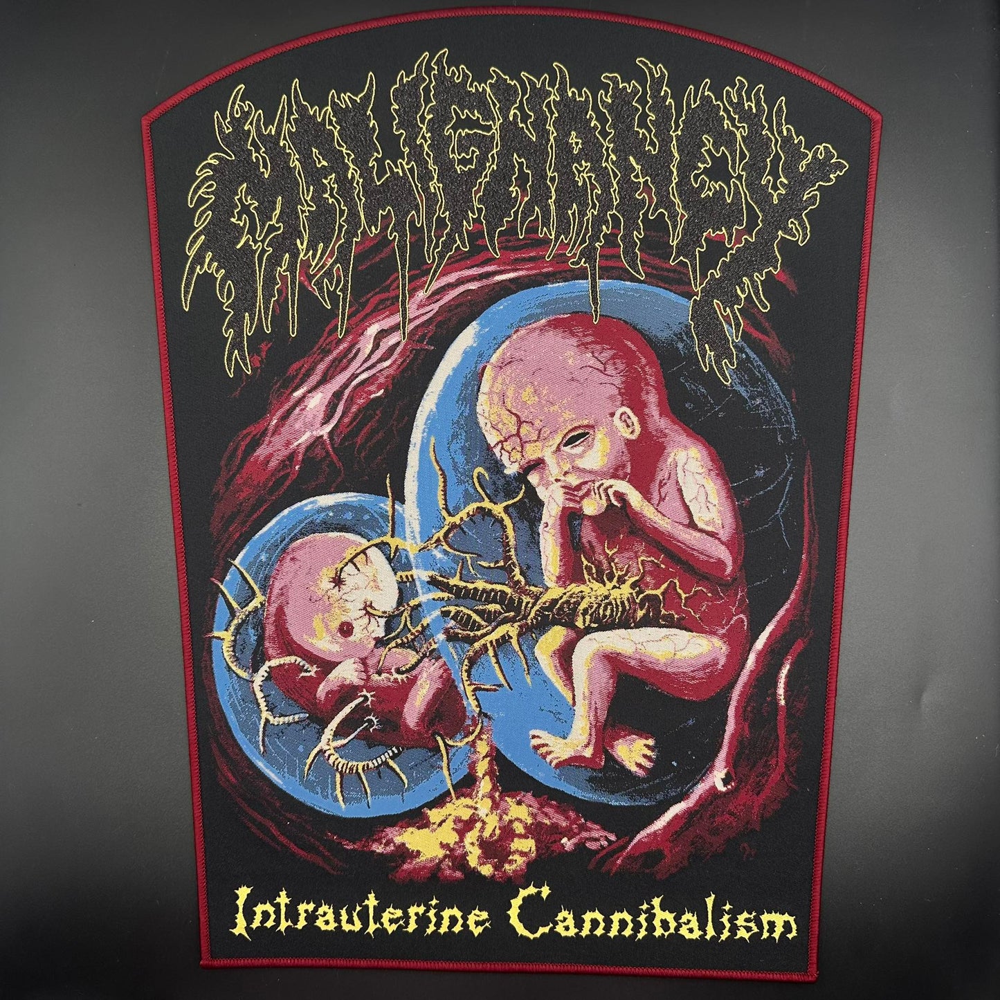 Malignancy - Intrauterine Cannibalism - Backpatch