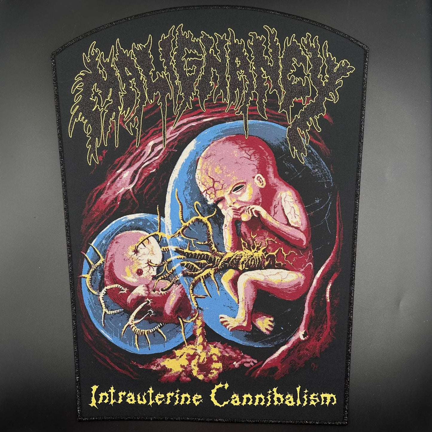 Malignancy - Intrauterine Cannibalism - Backpatch